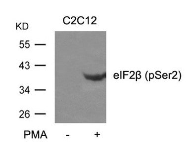 Western blot analysis of extracts from C2C12 cells untreated or treated with PMA using eIF2b(phospho-Ser2) Antibody.
