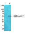 Western blot analysis of extracts from JK cells (Lane 2), using HS1 (Ab-397) antiobdy. The lane on the left is treated with synthesized peptide.