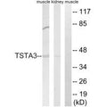 Western blot analysis of extracts from rat kidney cells and rat muscle cells, using TSTA3 antibody.