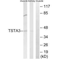 Western blot analysis of extracts from rat kidney cells and rat muscle cells, using TSTA3 antibody.