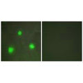 Immunofluorescence analysis of A549 cells, using FOXH1 antibody.