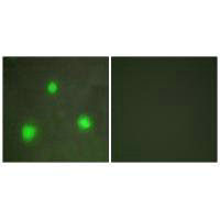 Immunofluorescence analysis of A549 cells, using FOXH1 antibody.