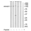 Western blot analysis of extracts from COLO205, HepG2, HuvEc and Jurkat cells, using ARHGEF1 antibody.