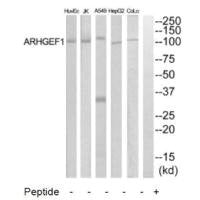Western blot analysis of extracts from COLO205, HepG2, HuvEc and Jurkat cells, using ARHGEF1 antibody.