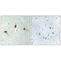 Immunohistochemistry analysis of paraffin-embedded human brain tissue using MSH2 antibody.