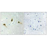 Immunohistochemistry analysis of paraffin-embedded human brain tissue using MSH2 antibody.