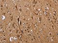The image on the left is immunohistochemistry of paraffin-embedded Human brain tissue using CSB-PA791777(ETV7 Antibody) at dilution 1/40, on the right is treated with fusion protein. (Original magnification: ×200)