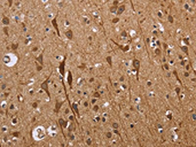 The image on the left is immunohistochemistry of paraffin-embedded Human brain tissue using CSB-PA791777(ETV7 Antibody) at dilution 1/40, on the right is treated with fusion protein. (Original magnification: ×200)
