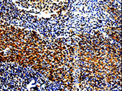 The image is immunohistochemistry of paraffin-embedded Human tonsil tissue using CSB-PA792911(TLR7 Antibody) at dilution 1/10. (Original magnification: 200)