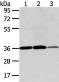 Gel: 8%SDS-PAGE, Lysate: 40 ug, Lane 1-3: Hela, 293T and 231 cell, Primary antibody: CSB-PA793155(VEGFA  Antibody) at dilution 1/400 dilution, Secondary antibody: Goat anti rabbit IgG at 1/8000 dilution, Exposure time: 30 seconds