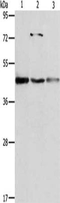 Gel: 10%SDS-PAGE, Lysate: 40 ug, Lane 1-3: Jurkat cells, MCF7 cells, hela cells, Primary antibody: CSB-PA793544(NFKBIB Antibody) at dilution 1/1050, Secondary antibody: Goat anti rabbit IgG at 1/8000 dilution, Exposure time: 40 seconds
