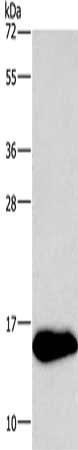 Gel: 8%SDS-PAGE, Lysate: 40 ug, Lane: Mouse brain tissue, Primary antibody: CSB-PA793948(NRGN Antibody) at dilution 1/300, Secondary antibody: Goat anti rabbit IgG at 1/8000 dilution, Exposure time: 5 seconds