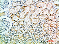 Immunohistochemical analysis of paraffin-embedded human-kidney, antibody was diluted at 1:200