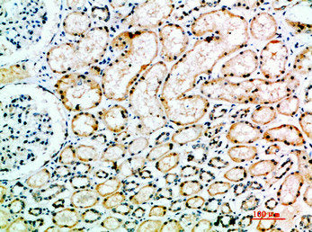 Immunohistochemical analysis of paraffin-embedded human-kidney, antibody was diluted at 1:200