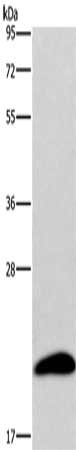 Gel: 10%SDS-PAGE, Lysate: 40 ug, Lane: Human testis tissue, Primary antibody: CSB-PA794202(AURKAIP1 Antibody) at dilution 1/600, Secondary antibody: Goat anti rabbit IgG at 1/8000 dilution, Exposure time: 1 minute