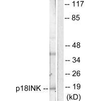 Western blot analysis of extracts from COS7 cells, using p18 INK antibody.