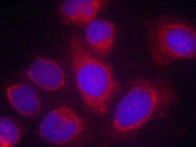 Immunofluorescence staining of methanol-fixed Hela cells using CPI17a(Ab-38) Antibody.