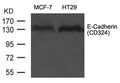 Western blot analysis of extract from MCF-7 and HT29 cells using E-Cadherin(CD324) Antibody