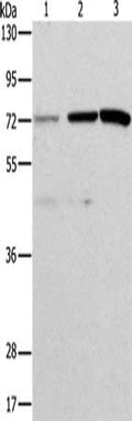 Gel: 10%SDS-PAGE, Lysate: 40 ug, Lane 1-3: Hela cells, SKOV3 cells, mouse liver tissue, Primary antibody: CSB-PA795497(ALS2CR11 Antibody) at dilution 1/500, Secondary antibody: Goat anti rabbit IgG at 1/8000 dilution, Exposure time: 5 minutes