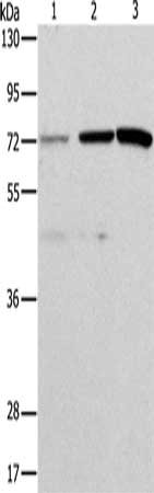Gel: 10%SDS-PAGE, Lysate: 40 ug, Lane 1-3: Hela cells, SKOV3 cells, mouse liver tissue, Primary antibody: CSB-PA795497(ALS2CR11 Antibody) at dilution 1/500, Secondary antibody: Goat anti rabbit IgG at 1/8000 dilution, Exposure time: 5 minutes