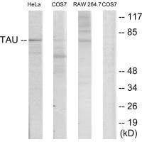 Western blot analysis of extracts from HeLa/COS7/RAW246.7 cells, using Tau (Ab-235) antibody.