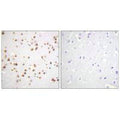 Immunohistochemistry analysis of paraffin-embedded human brain tissue using Catenin-δ1 (Ab-228) antibody.
