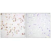 Immunohistochemistry analysis of paraffin-embedded human brain tissue using Catenin-δ1 (Ab-228) antibody.