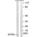 Western blot analysis of extracts from COLO cells, using ATP5I antibody.