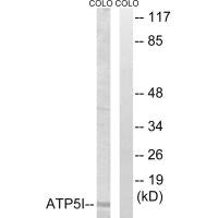 Western blot analysis of extracts from COLO cells, using ATP5I antibody.