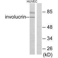 Western blot analysis of extracts from HuvEc cells, using Involucrin antibody.
