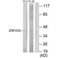 Western blot analysis of extracts from NIH-3T3 cells and HT-29 cells, using ZNF435 antibody.