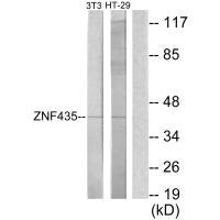 Western blot analysis of extracts from NIH-3T3 cells and HT-29 cells, using ZNF435 antibody.