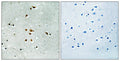 Immunohistochemical analysis of paraffin-embedded human brain tissue using FER (Phospho-Tyr402) antibody (left)or the same antibody preincubated with blocking peptide (right).
