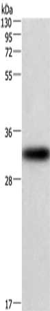 Gel: 6%SDS-PAGE, Lysate: 40 ug, Lane: 293T cells, Primary antibody: CSB-PA798488(CENPP Antibody) at dilution 1/449, Secondary antibody: Goat anti rabbit IgG at 1/8000 dilution, Exposure time: 2 minutes