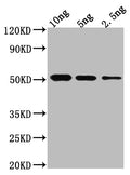 Western Blot
Positive WB detected in Recombinant protein
All lanes: BRO1 antibody at 1:2000
Secondary
Goat polyclonal to rabbit IgG at 1/50000 dilution
Predicted band size: 49.9 kDa
Observed band size: 54 kDa