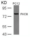 Western blot analysis of extracts from PC12 cells using PKCth(Ab-676) Antibody.