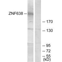 Western blot analysis of extracts from HepG2 cells, treated with serum (20%, 15mins), using ZNF638 antibody.