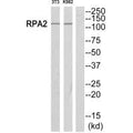 Western blot analysis of extracts from Jurkat/NIH-3T3 cells, using POLR1B antibody.