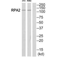 Western blot analysis of extracts from Jurkat/NIH-3T3 cells, using POLR1B antibody.
