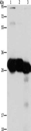 Gel: 15%SDS-PAGE, Lysate: 40 ug, Lane 1-3: Mouse liver tissue, Mouse kidney tissue, human fetal liver tissue, Primary antibody: CSB-PA799800(KHK Antibody) at dilution 1/1350, Secondary antibody: Goat anti rabbit IgG at 1/8000 dilution, Exposure time: 3 seconds