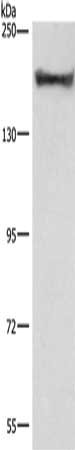 Gel: 6%SDS-PAGE, Lysate: 40 ug, Lane: 293T cells, Primary antibody: CSB-PA799985(COL4A2 Antibody) at dilution 1/1350, Secondary antibody: Goat anti rabbit IgG at 1/8000 dilution, Exposure time: 1 minute