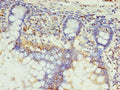 Immunohistochemistry of paraffin-embedded human small intestine tissue using CSB-PA800097LA01HU at dilution of 1:100