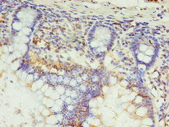 Immunohistochemistry of paraffin-embedded human small intestine tissue using CSB-PA800097LA01HU at dilution of 1:100
