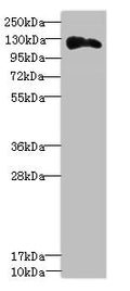 Western blot All lanes: ANLNantibody at 3.43ug/ml + Hela whole cell lysate Secondary Goat polyclonal to rabbit IgG at 1/10000 dilution Predicted band size: 125, 121 kDa Observed band size: 125 kDa