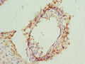 Immunohistochemistry of paraffin-embedded human testis tissue using CSB-PA800281ESR2HU at dilution of 1:100