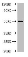 Western Blot
Positive WB detected in: K562 whole cell lysate
All lanes: SGMS1 antibody at 4µg/ml
Secondary
Goat polyclonal to rabbit IgG at 1/50000 dilution
Predicted band size: 49, 26 kDa
Observed band size: 49 kDa