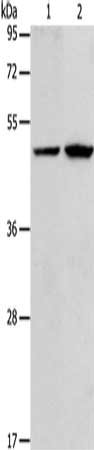 Gel: 10%SDS-PAGE, Lysate: 40 ug, Lane 1-2: K562 cells, human normal liver tissue, Primary antibody: CSB-PA802143(RARB Antibody) at dilution 1/283, Secondary antibody: Goat anti rabbit IgG at 1/8000 dilution, Exposure time: 20 seconds