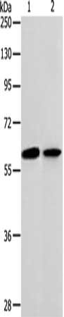 Gel: 10%SDS-PAGE, Lysate: 40 ug, Lane 1-2: NIH/3T3 cells, human ovarian cancer tissue, Primary antibody: CSB-PA802152(ABCE1 Antibody) at dilution 1/300, Secondary antibody: Goat anti rabbit IgG at 1/8000 dilution, Exposure time: 1 minute