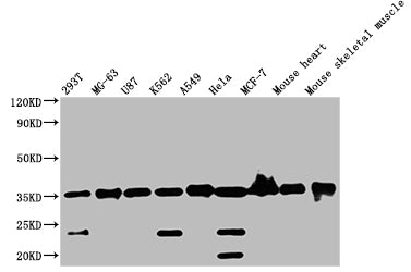 Western Blot
Positive WB detected in: Mouse skeletal muscle tissue
All lanes: ANKRD23 antibody at 2.5µg/ml
Secondary
Goat polyclonal to rabbit IgG at 1/50000 dilution
Predicted band size: 35, 30 kDa
Observed band size: 35 kDa