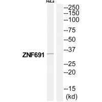 Western blot analysis of extracts from HeLa cells, using ZNF691 antibody.